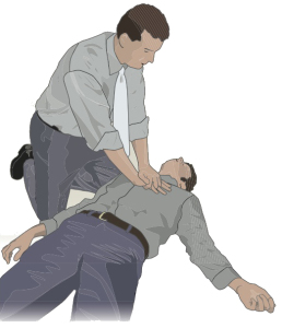 CPR chest compressions